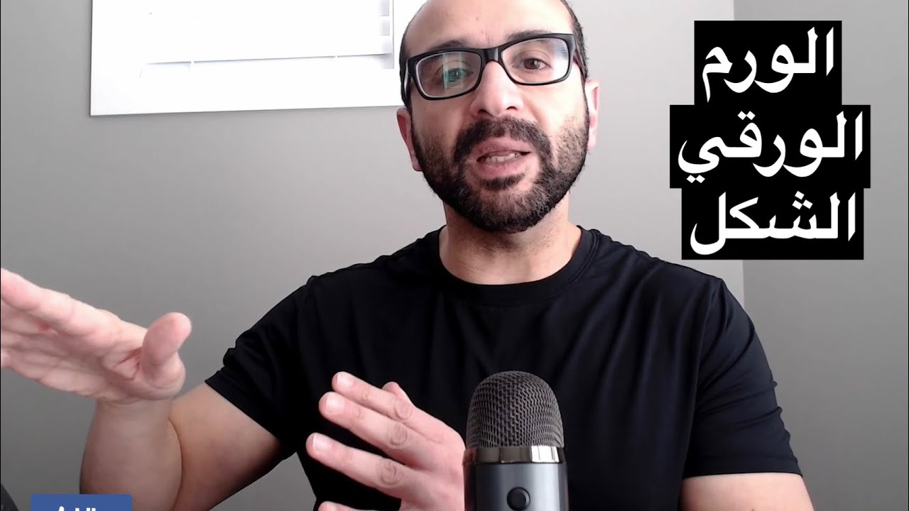 الاورام الحميدة للثدي ….. الورم الورقي الشكل… ما هي اعراضه؟ .. كيف يتم التشخيص؟  Phyllodes Tumor