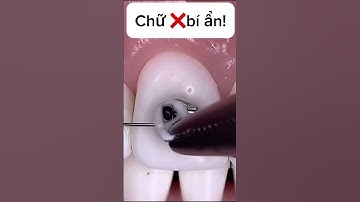 Bạn thích kiểu nào nhất? #shorts #video #niengrang #shortsvideo #lamdep #dentist