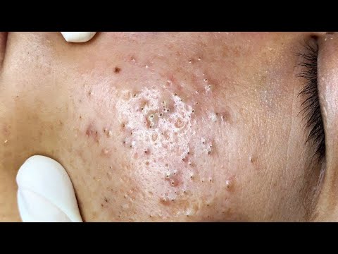 ABRO HILO - PRIMO y TÍO con DERECHO M4TAN a MI GATO con SUS RESORTERAS