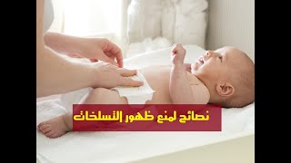 تسلخات الحفاض عند الرضع - علاج تسلخات الاطفال - اطفال - التهاب الحفاضات عند الرضع