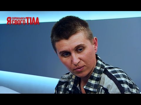 32-летний мужчина считает себя гермафродитом - Я соромлюсь свого тіла - 15.05.15