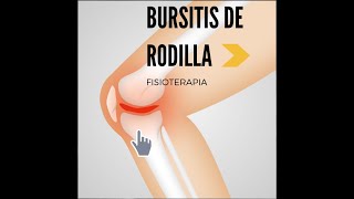 ¿Cómo saber si tengo bursitis en la rodilla?