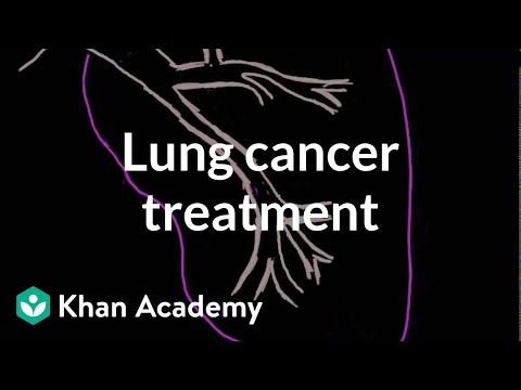 Video: Léčba Hepatocelulárního Karcinomu: Stage, Targeted Therapy