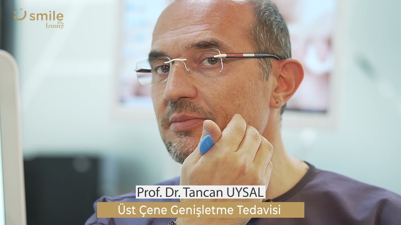 Üst Çene Genişletme Tedavisi (Rapid Palatal Ekspansiyon - RPE )