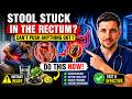 Stool STUCK In The RECTUM? Here's What To Do Immediately! | Dr Thomas Morgan