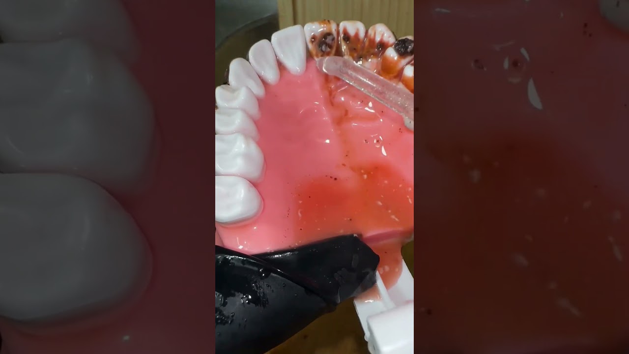 Bad Breath Tips ….