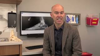 What Causes Hammertoe?