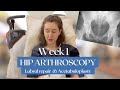Week 1 Post-Surgery Experience: Labral repair &amp; Acetabuloplasty  | Hip Arthroscopy Journey