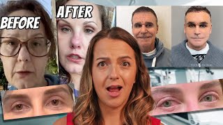 Plastic surgery trends have gone TOO FAR