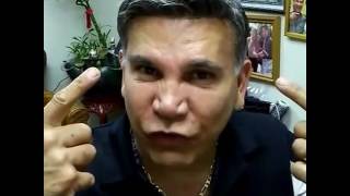 Hair Replacement for Men Hair loss, Baldness, Hair Wigs, Hair toupees, Hair pieces No- surgical