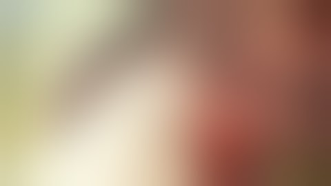 Motor cortex stimulation for Chronic pain Video