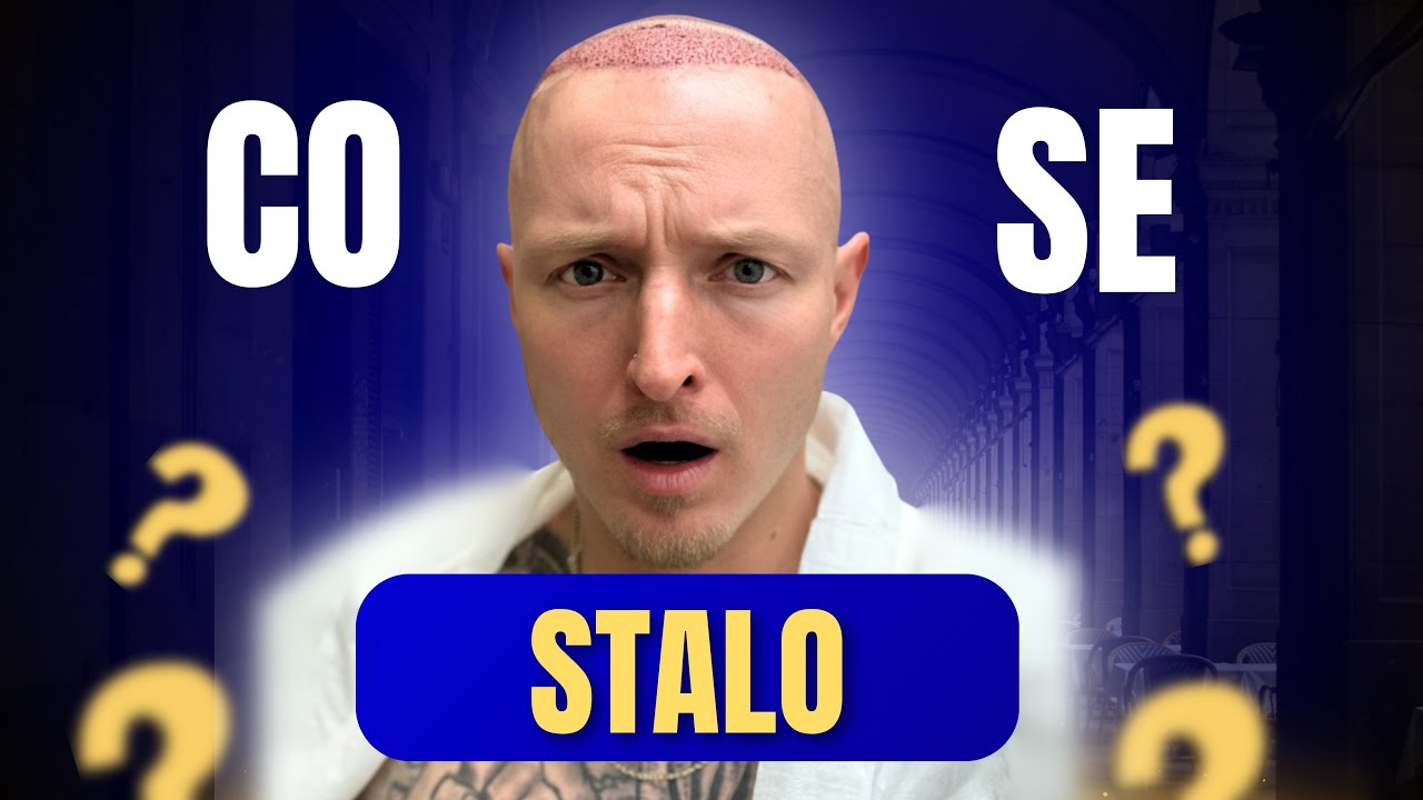 PŘIŠEL JSEM O VLASY