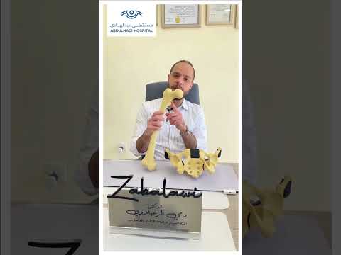 الدكتور رامي زعبلاوي يتحدث عن فحص خلع الولادة