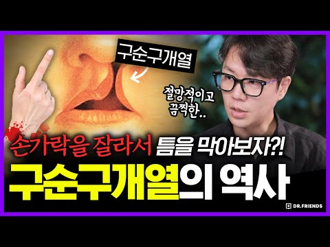 마취도 없이 불로 지지고 철실로 꿰맨다고..? | 의학의 역사 구순구개열