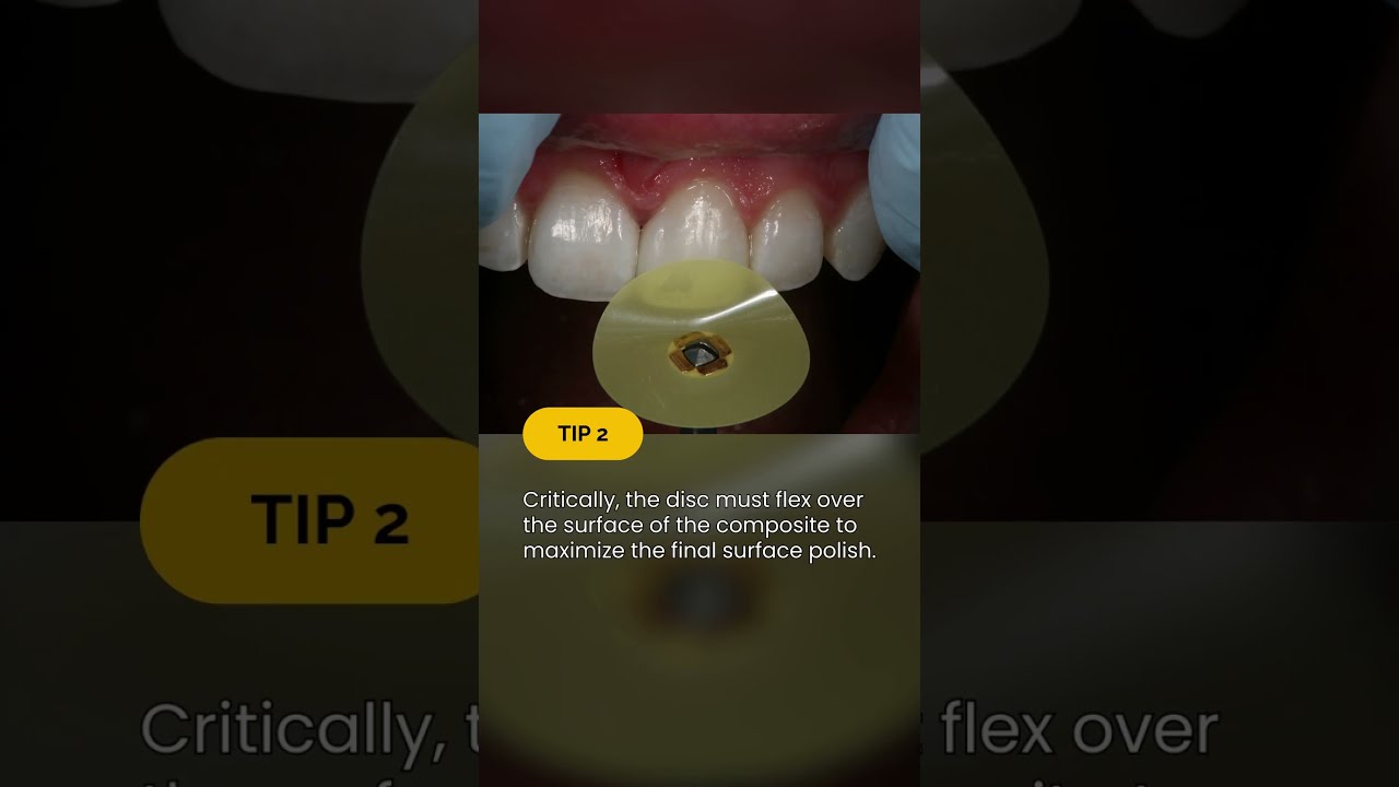 Composite Polishing Technique Tips | Dental Online Training 