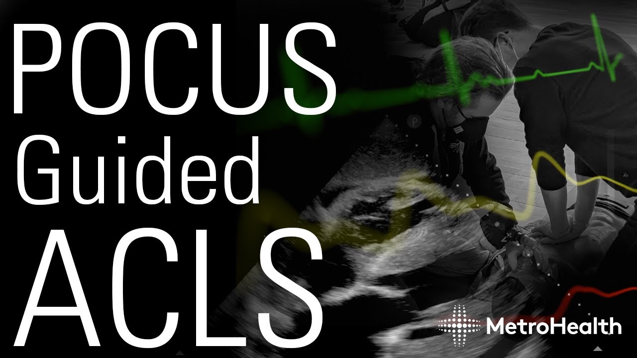 Ultrasound in Cardiac Arrest