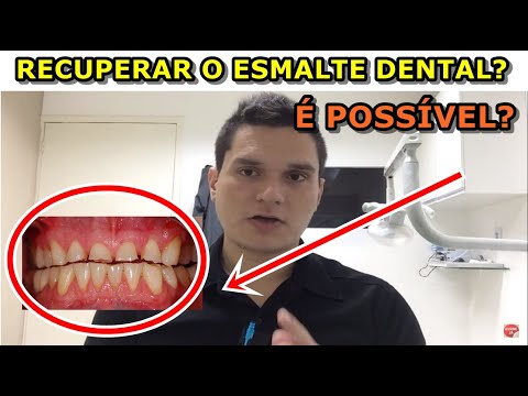 É possível recuperar o esmalte dental? A verdade revelada.