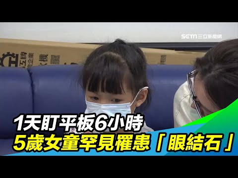 1天盯平板6小時 5歲女童罕見罹患「眼結石」｜三立新聞台