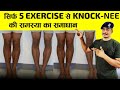 knok knee problem solve only 1 month || सिर्फ़ 1 महीने मैं knok knee problem कर लो ठीक