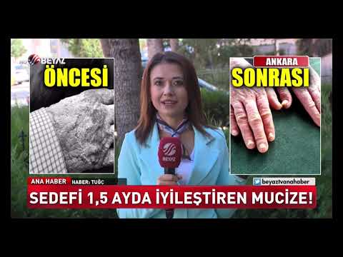 Sedefi bir buçuk ayda iyileştiren mucize!