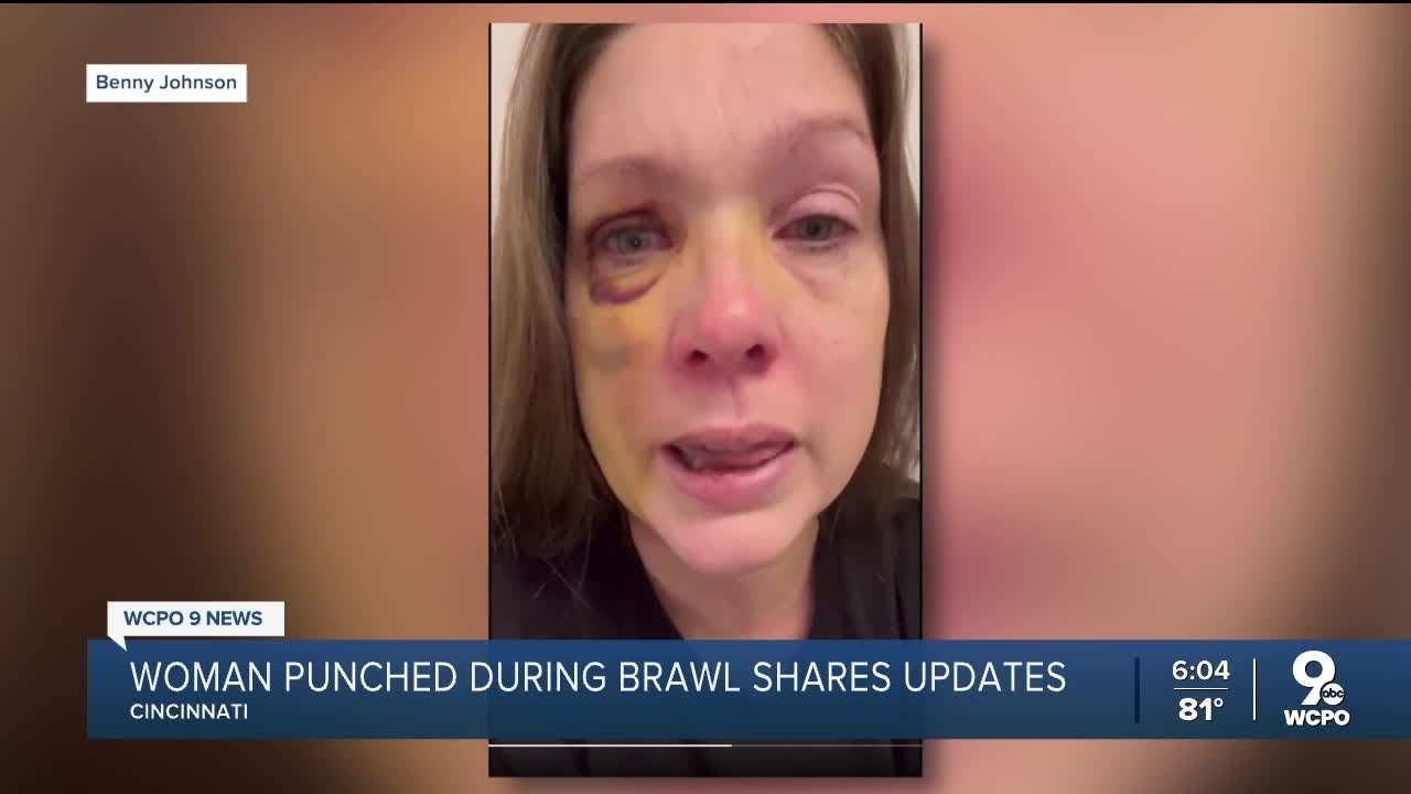 Woman punched during downtown Cincinnati fight speaks out