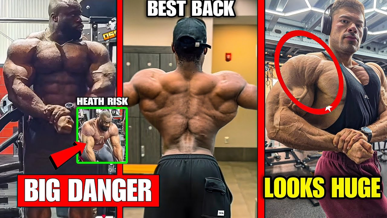 Samson Dauda "BIG HEALTH RISK"😭 For 400 LBS Weight., Wesley Vissers Physique Update, Emanuel Hunter