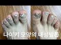 [시원함주의!!]ENG/KOR😀안녕하세요. 우리 칰이들👋 NIKE 모양의 내성발톱 영상이예요.