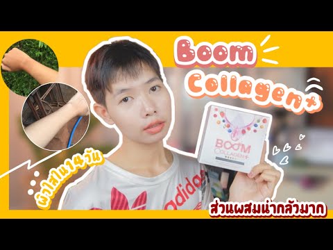 Boom collagen รีวิว กินคอลลาเจนผิวขาวได้หรอ? |อีสานพาสวย