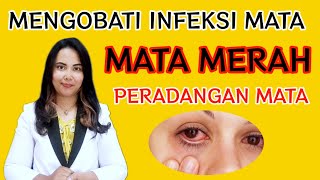 Kumpulan Obat Mata Di Apotek || Infeksi Mata - Mata Merah - Peradangan Mata