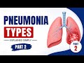 Pneumonia Types in Easy Way | Part 2