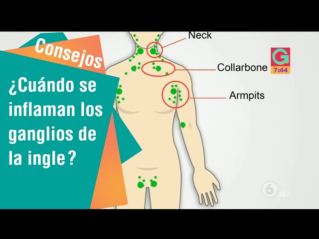 bulto en la ingle derecha