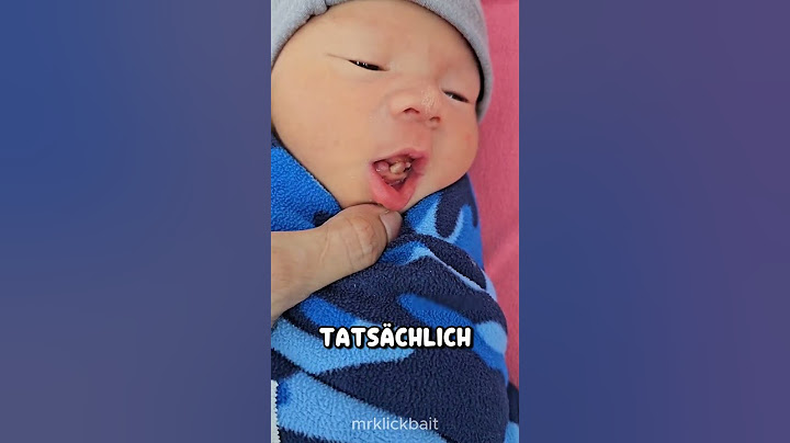 Warum haben sie überhaupt schon Zähne? 🤔