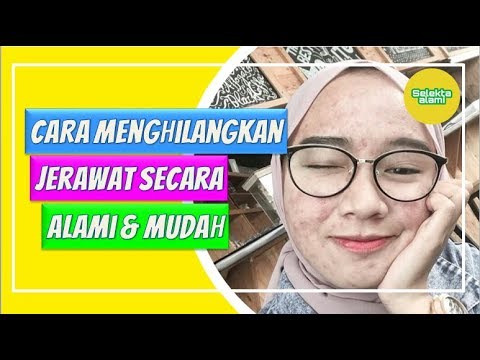 CARA MENGHILANGKAN JERAWAT SECARA ALAMI DAN MUDAH 