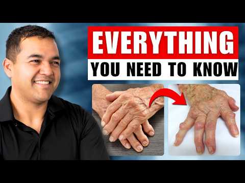 Everything You Need to Know About Hand Arthritis (Symptoms & Treatment)