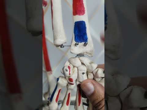 كسور عظام د محمد الشاعر اكسبلور