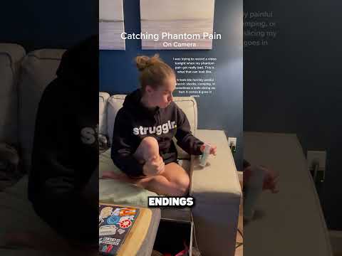 She Has Phantom Pain! 😖🧠
