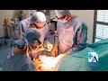 Bypass gastrique en ambulatoire 🏥