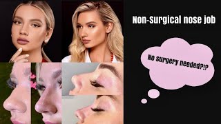 I GOT A NOSE JOB...AND I DIDN'T NEED TO GO UNDER ANESTHESIA!!