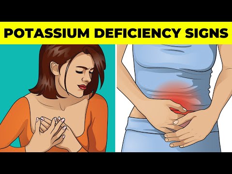 9 Signs Of A Potassium Deficiency You Should Never Ignore
