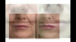 Botox Juvederm Restylane Laser Hair Removal West Palm Beach Lake Worth