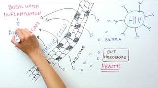 A GUT REACTION TO HIV: How the gut microbiome influences progression to AIDS
