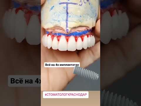 Улыбайтесь чаще! 🤩 #стоматолог #стоматология #улыбка #юмор #доктор