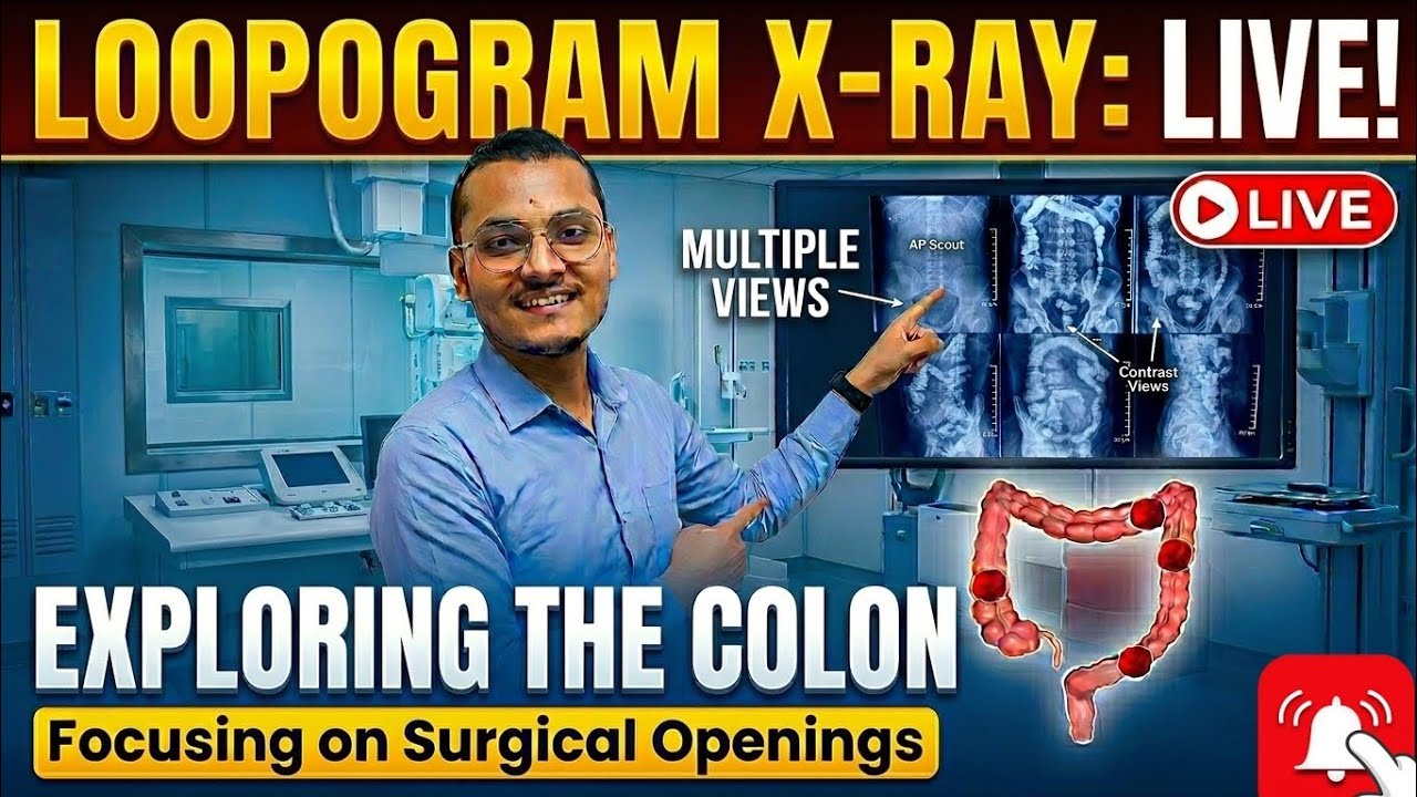 Loopogram Radiograph LOOPOGRAM X RAY LIVE - YouTube