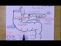 Acute pancreatitis  handmade easy notes