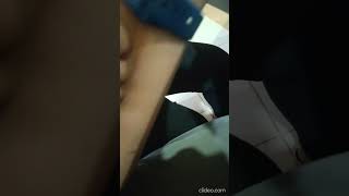 Hard Nails Scratching On Arm By Girlfriend