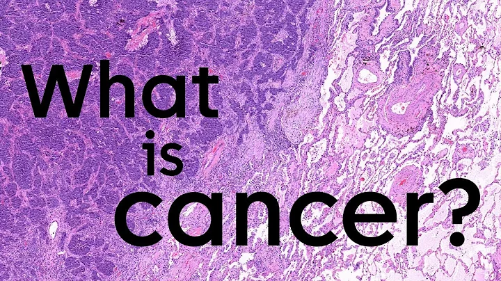What is cancer and how does it start? | Cancer Research UK