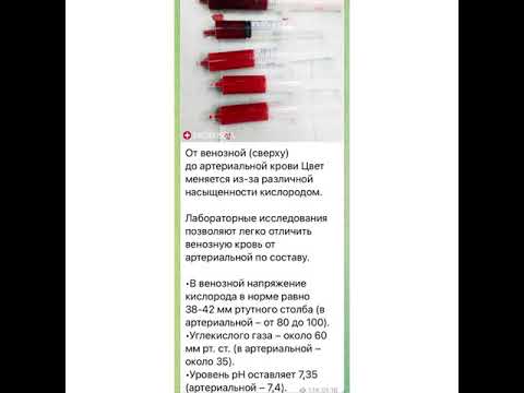 Медицина: От венозной/сверху/