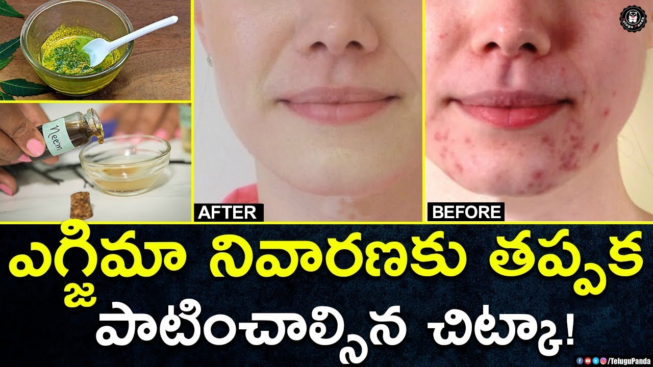 Neem Oil Benefits For Eczema Relief Home Remedies For Skin Disorders