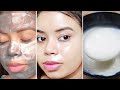 Super GLOSSY SKIN at Home | I used these 3 steps on my skin & it removed Dark Spots, Pigmentation