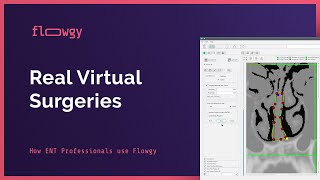 Real Virtual Surgery – Bilateral Nasal Obstruction | Flowgy Academy